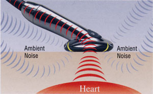 `mq(Ambient Noise Reduction)eNmW[